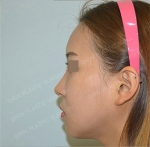 GIRIN Plastic Surgery. GIRIN aesthetic Clinic — Korea cost, reviews & before-after | MISOODA