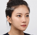 GNG Hospital, Reviews, Images, Promotions — Korea cost, reviews & before-after | MISOODA
