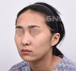 GNG Hospital, Reviews, Images, Promotions — Korea cost, reviews & before-after | MISOODA