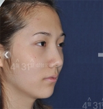 April 31 Plastic Surgery,Reviews,Images,Promotions — Korea cost, reviews & before-after | MISOODA