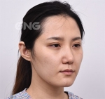 GNG Hospital, Reviews, Images, Promotions — Korea cost, reviews & before-after | MISOODA