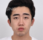 GNG Hospital, Reviews, Images, Promotions — Korea cost, reviews & before-after | MISOODA