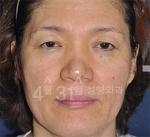 April 31 Plastic Surgery,Reviews,Images,Promotions — Korea cost, reviews & before-after | MISOODA