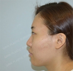 GIRIN Plastic Surgery. GIRIN aesthetic Clinic — Korea cost, reviews & before-after | MISOODA