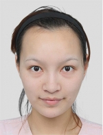 DA Plastic Surgery, Reviews, Images, Promotions — Korea cost, reviews & before-after | MISOODA