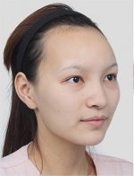 DA Plastic Surgery, Reviews, Images, Promotions — Korea cost, reviews & before-after | MISOODA