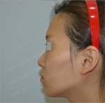 GIRIN Plastic Surgery. GIRIN aesthetic Clinic — Korea cost, reviews & before-after | MISOODA