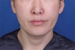 Deesse Plastic Surgery, Reviews,Images, Promotions — Korea cost, reviews & before-after | MISOODA
