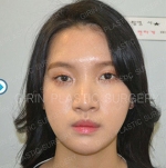 GIRIN Plastic Surgery. GIRIN aesthetic Clinic — Korea cost, reviews & before-after | MISOODA