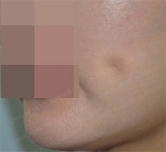 GIRIN Plastic Surgery. GIRIN aesthetic Clinic — Korea cost, reviews & before-after | MISOODA