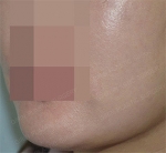 GIRIN Plastic Surgery. GIRIN aesthetic Clinic — Korea cost, reviews & before-after | MISOODA