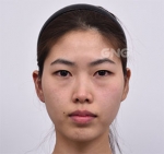 GNG Hospital, Reviews, Images, Promotions — Korea cost, reviews & before-after | MISOODA