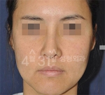 April 31 Plastic Surgery,Reviews,Images,Promotions — Korea cost, reviews & before-after | MISOODA