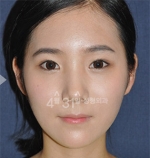 April 31 Plastic Surgery,Reviews,Images,Promotions — Korea cost, reviews & before-after | MISOODA