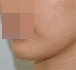 GIRIN Plastic Surgery. GIRIN aesthetic Clinic — Korea cost, reviews & before-after | MISOODA