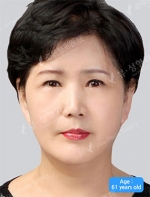 View Plastic Surgery, Reviews, Images, Promotions — Korea cost, reviews & before-after | MISOODA