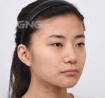 GNG Hospital, Reviews, Images, Promotions — Korea cost, reviews & before-after | MISOODA