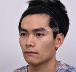GNG Hospital, Reviews, Images, Promotions — Korea cost, reviews & before-after | MISOODA