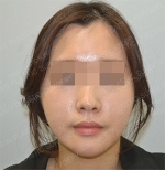 GIRIN Plastic Surgery. GIRIN aesthetic Clinic — Korea cost, reviews & before-after | MISOODA
