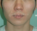 April 31 Plastic Surgery,Reviews,Images,Promotions — Korea cost, reviews & before-after | MISOODA