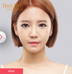 Theline Plastic Surgery,Reviews,Images, Promotions — Korea cost, reviews & before-after | MISOODA