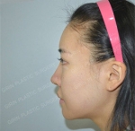 GIRIN Plastic Surgery. GIRIN aesthetic Clinic — Korea cost, reviews & before-after | MISOODA