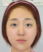 GIRIN Plastic Surgery. GIRIN aesthetic Clinic — Korea cost, reviews & before-after | MISOODA