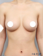 DA Plastic Surgery, Reviews, Images, Promotions — Korea cost, reviews & before-after | MISOODA
