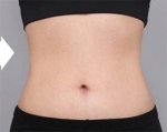 DA Plastic Surgery, Reviews, Images, Promotions — Korea cost, reviews & before-after | MISOODA