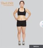 Theline Plastic Surgery,Reviews,Images, Promotions — Korea cost, reviews & before-after | MISOODA