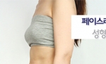 Faceline Plastic Surgery, Reviews,Images,Promotions — Korea cost, reviews & before-after | MISOODA