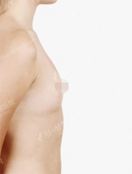 View Plastic Surgery, Reviews, Images, Promotions — Korea cost, reviews & before-after | MISOODA