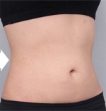 DA Plastic Surgery, Reviews, Images, Promotions — Korea cost, reviews & before-after | MISOODA