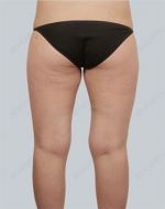 ID Plastic Surgery , Reviews, Images, Promotions — Korea cost, reviews & before-after | MISOODA