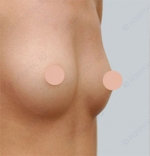 ID Plastic Surgery , Reviews, Images, Promotions — Korea cost, reviews & before-after | MISOODA