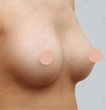 ID Plastic Surgery , Reviews, Images, Promotions — Korea cost, reviews & before-after | MISOODA