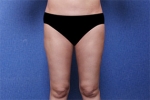 Deesse Plastic Surgery, Reviews,Images, Promotions — Korea cost, reviews & before-after | MISOODA