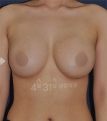 April 31 Plastic Surgery,Reviews,Images,Promotions — Korea cost, reviews & before-after | MISOODA