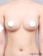 DA Plastic Surgery, Reviews, Images, Promotions — Korea cost, reviews & before-after | MISOODA