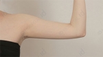 ID Plastic Surgery , Reviews, Images, Promotions — Korea cost, reviews & before-after | MISOODA