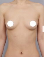 DA Plastic Surgery, Reviews, Images, Promotions — Korea cost, reviews & before-after | MISOODA