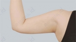 ID Plastic Surgery , Reviews, Images, Promotions — Korea cost, reviews & before-after | MISOODA
