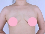 Faceline Plastic Surgery, Reviews,Images,Promotions — Korea cost, reviews & before-after | MISOODA