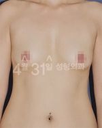 April 31 Plastic Surgery,Reviews,Images,Promotions — Korea cost, reviews & before-after | MISOODA