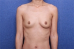 Deesse Plastic Surgery, Reviews,Images, Promotions — Korea cost, reviews & before-after | MISOODA