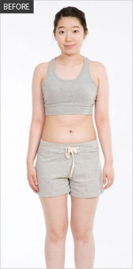 Banobagi Plastic Surgery,Reviews,Images, Promotions, MISOODA — Korea cost, reviews & before-after | MISOODA