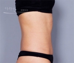 Theline Plastic Surgery,Reviews,Images, Promotions — Korea cost, reviews & before-after | MISOODA