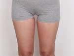 Faceline Plastic Surgery, Reviews,Images,Promotions — Korea cost, reviews & before-after | MISOODA