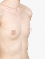 View Plastic Surgery, Reviews, Images, Promotions — Korea cost, reviews & before-after | MISOODA