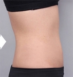 DA Plastic Surgery, Reviews, Images, Promotions — Korea cost, reviews & before-after | MISOODA